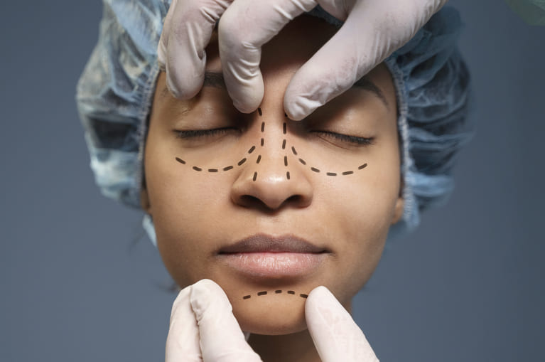 Plastischechirurgie